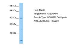 RAB3GAP1 Rabbit anti-Human, Polyclonal, Novus Biologicals 0.1 mL | Buy Online | Novus Biologicals | Fisher Scientific